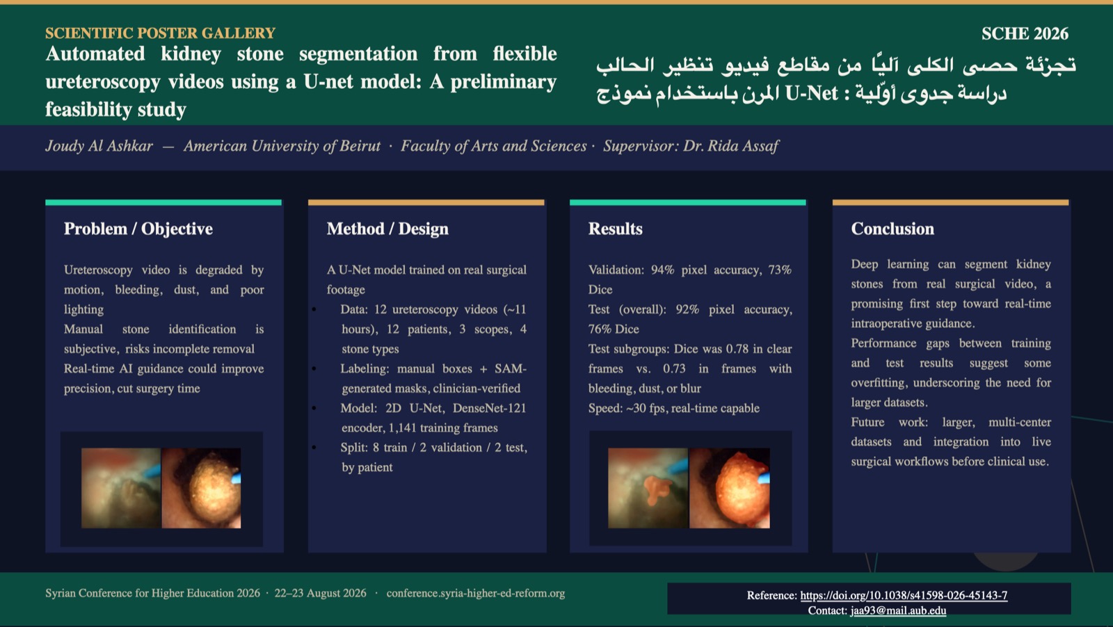 معاينة الملصق: تجزئة حصى الكلى آليًّا من مقاطع فيديو تنظير الحالب المرن باستخدام نموذج U-Net: دراسة جدوى أوّلية